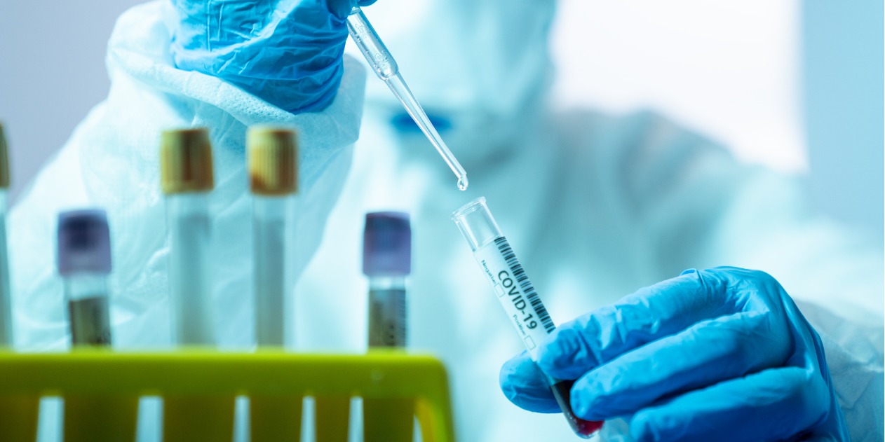 Diez medidas para luchar contra la próxima pandemia Diez medidas para luchar contra la próxima pandemia